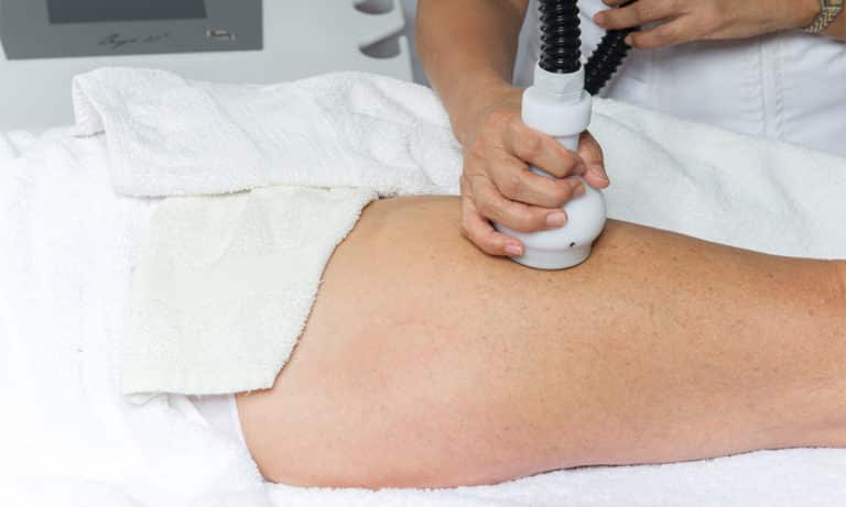 Cryolipolyse Amsterdam: Vetcellen bevriezen met de Cryo21 3 cryolipolyse-behandeling-benen