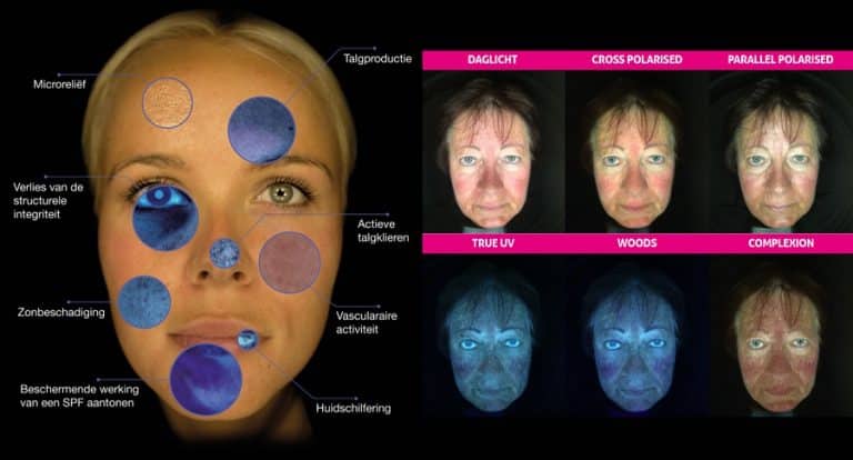 Skin scan Amsterdam