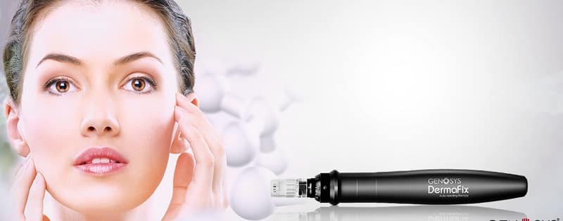 Dermapen behandeling Amsterdam 1 dermapen-behandeling-amsterdam