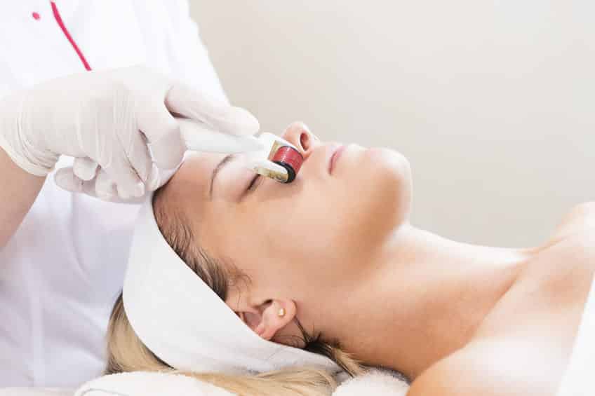 Microneedling Amsterdam. De nummer 1 in Microneedling 1 Microneedling-behandeling-amsterdam