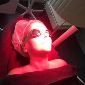 Collagen treatment