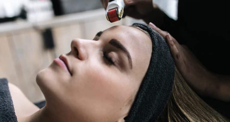 Microneedling Amsterdam 5 Microneedling amsterdam