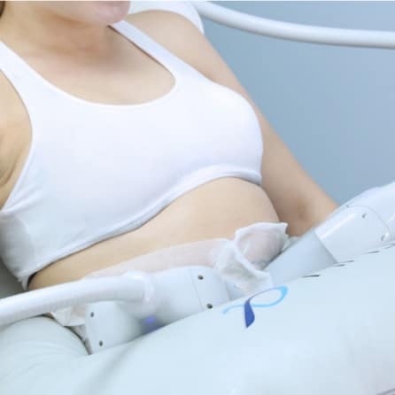 Cryolipolyse vet bevriezen 1 Vet bevriezen