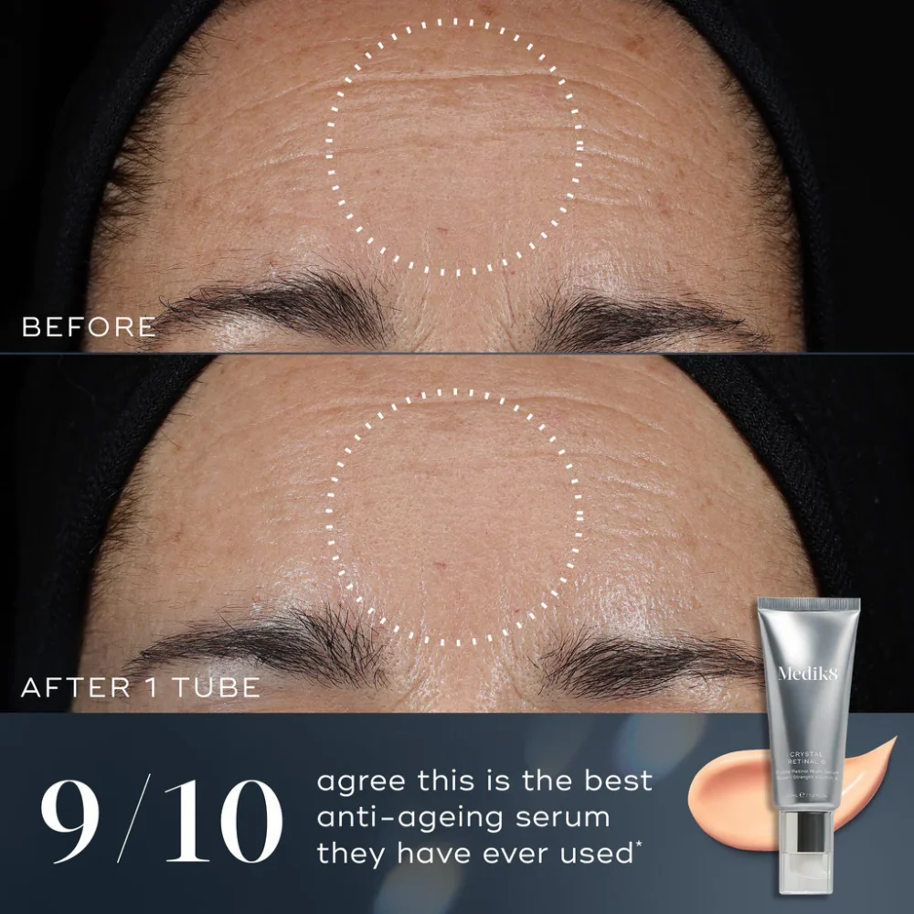 Beste Retinal Serum