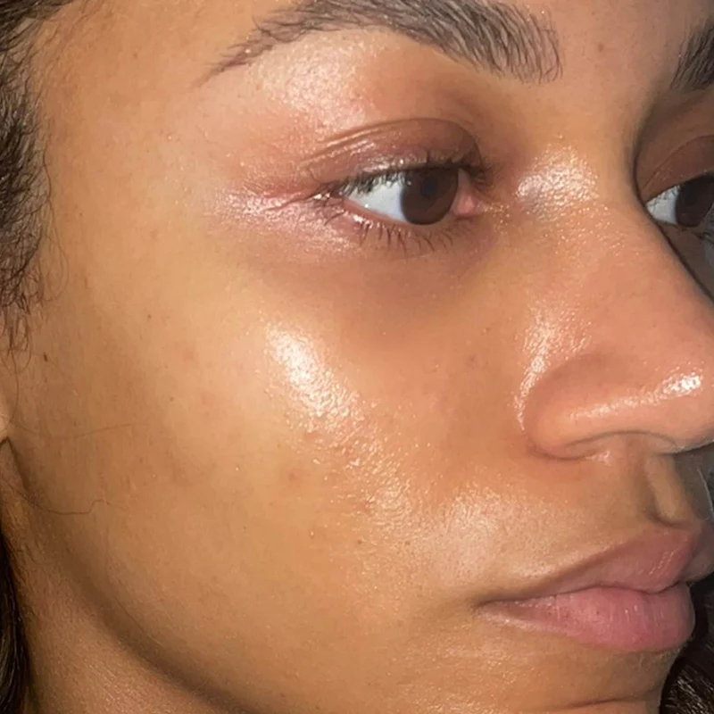 Medik8 Crystal Retinal 3 12 Resultaat na 10 dagen image