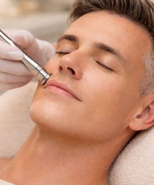 microdermabrasie in Amsterdam.